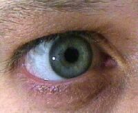 Augen weit auf